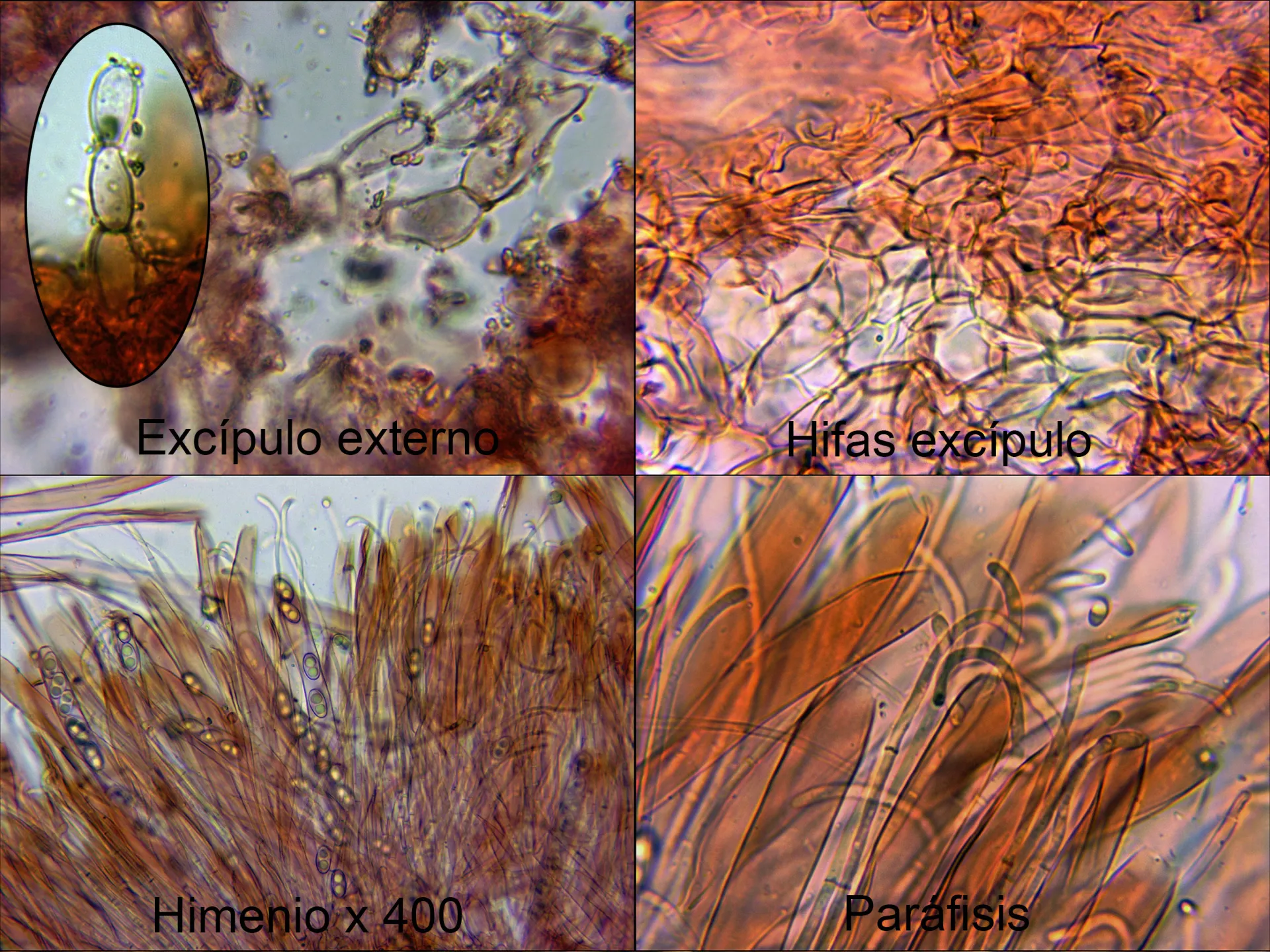 Microscopía de 11 - Otidea onotica micro
